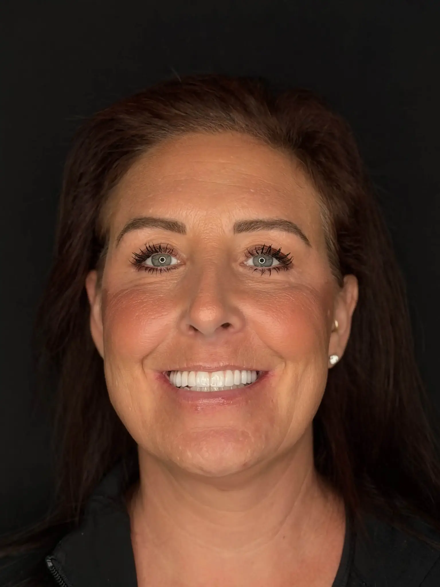 Christie smiling after her dental implant and Invisalign treatment at Bright Smiles Family Dentistry in Garner, NC