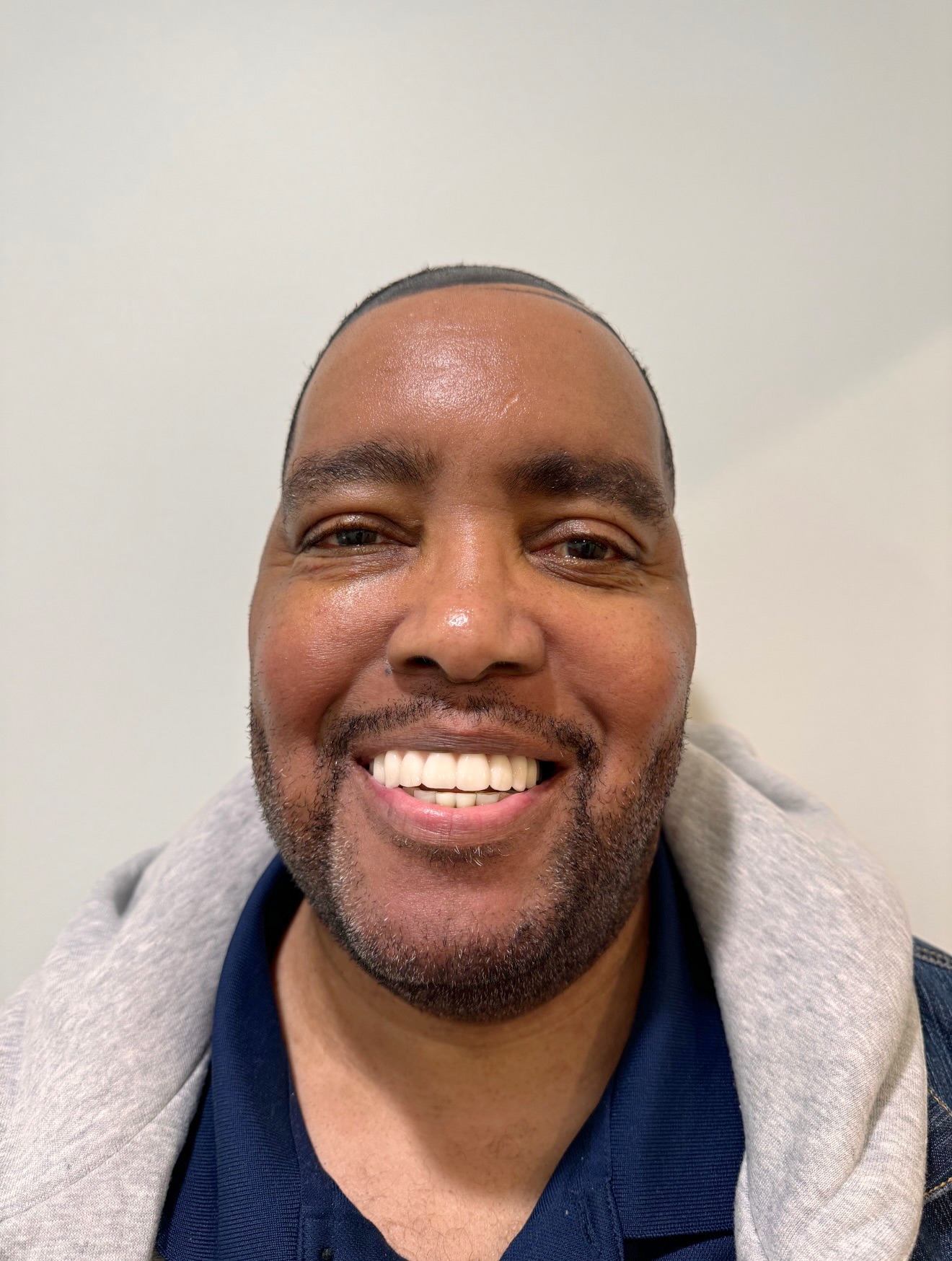 Pastor Andrew after dental implant treatment
